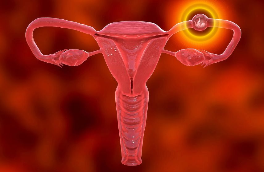 Ectopic Pregnancy Treatment in Pune | Dr. Shruti Patil – Best Gynecologist & High-Risk Pregnancy Specialist Ectopic pregnancy treatment in Pune by Dr. Shruti Patil — expert gynecologist offering advanced diagnosis, laparoscopic surgery, and compassionate care for women’s reproductive health.