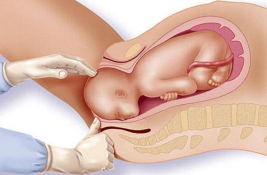 Choosing a Vaginal Delivery with Dr Shruti Patil – Safe, Natural, and Empowering Birth Experience in Pune vaginal childbirth with Dr Shruti Patil – trusted gynaecologist in Pune providing safe, natural, and empowering maternity care.
