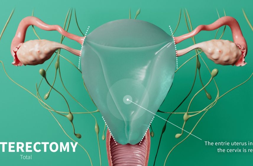 Understanding Hysterectomy – Procedure, Types, and Recovery Experienced gynecologist explaining hysterectomy procedure to a woman patient in a modern clinic in Pune.