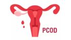 Woman consulting Dr Shruti Patil, best gynecologist in Pune, for PCOD and irregular periods treatment.