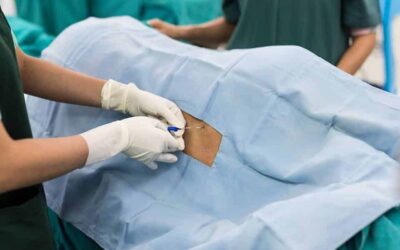 Pregnant woman in labor looking calm and comfortable during epidural-assisted delivery