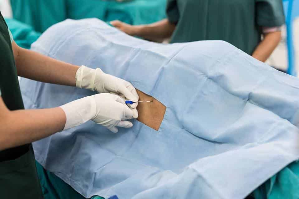 Pregnant woman in labor looking calm and comfortable during epidural-assisted delivery